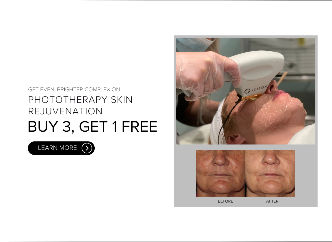 PHOTOTHERAPY_CALGARY_PROMOTION