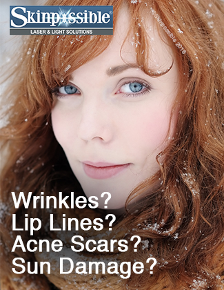 wrinkles-OCT