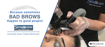 microblading removal brow removal calgary